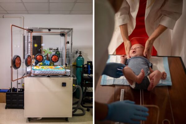 Infant Metabolism Study